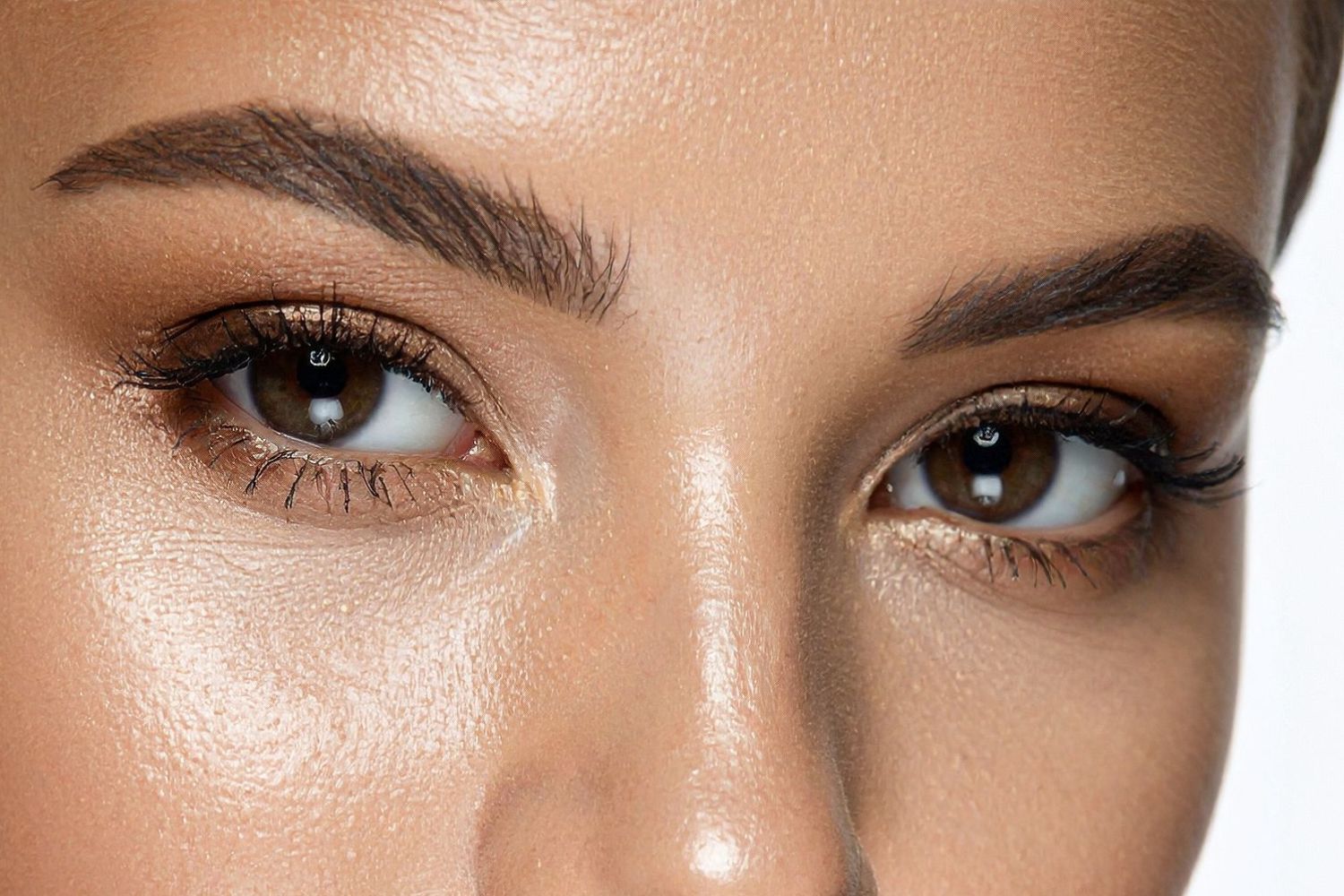 Subtle Botox treatment for forehead lines and brows designed to preserve natural expression