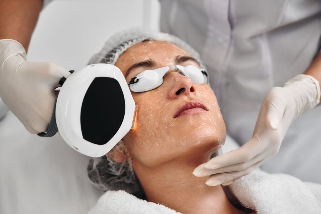 IPL Photofacials Queen Creek AZ