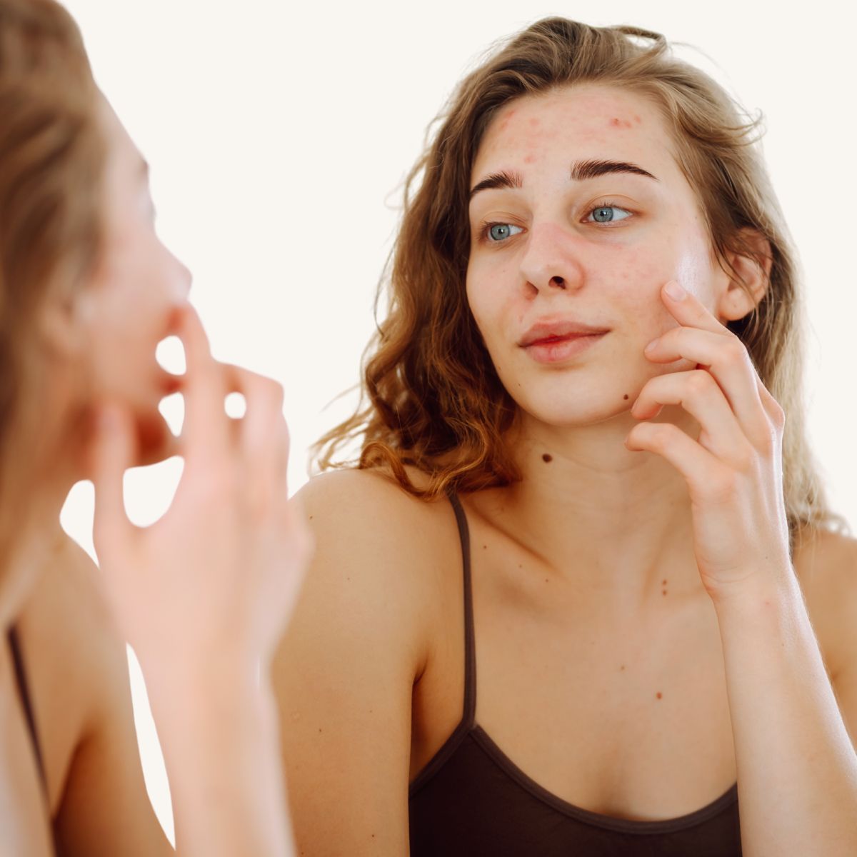 redness treatment queen creek